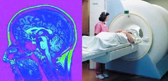 MRI